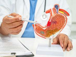 Why Stomach Acid Isn’t the Enemy: The Real Cause of Heartburn and Bloating