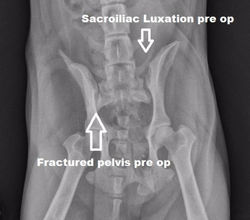 FRACTURE PELVIS/ SI LUXATION