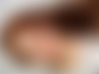 Iluminada com Técnica Strobing