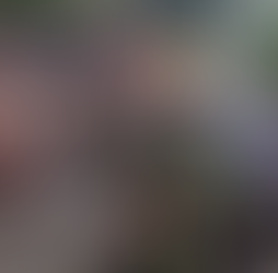 Inquilino agredió brutalmente a vigilante tras impedirle parquear su vehículo