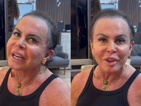 Gretchen aparece sem prótese capilar e revela destino de cabelo