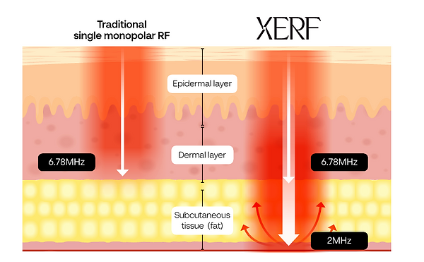 xerf_dual_frequency_diagram_optimized-1.png