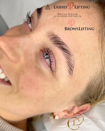 Browlifting
