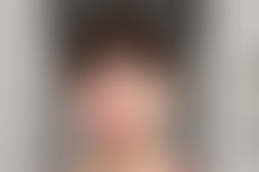 Rozācija un tās ārstēšana