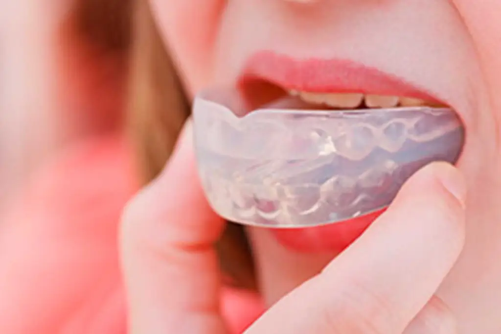 dentisaude-medicina-dentaria-tratamentos-oclusao.webp