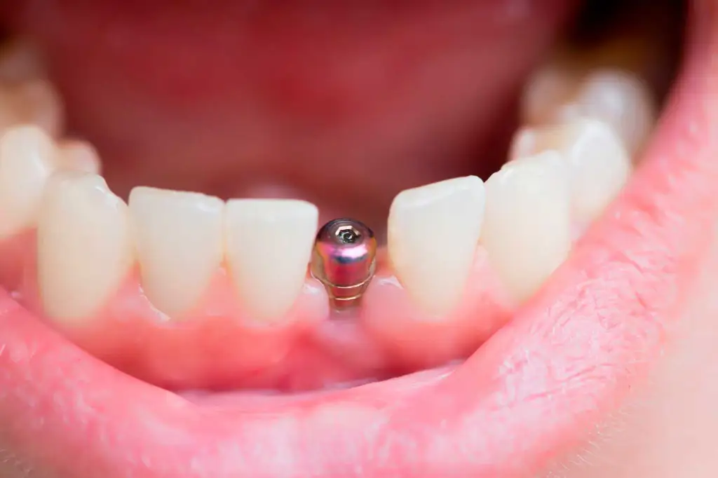 dentisaude-medicina-dentaria-tratamentos-higiene.webp