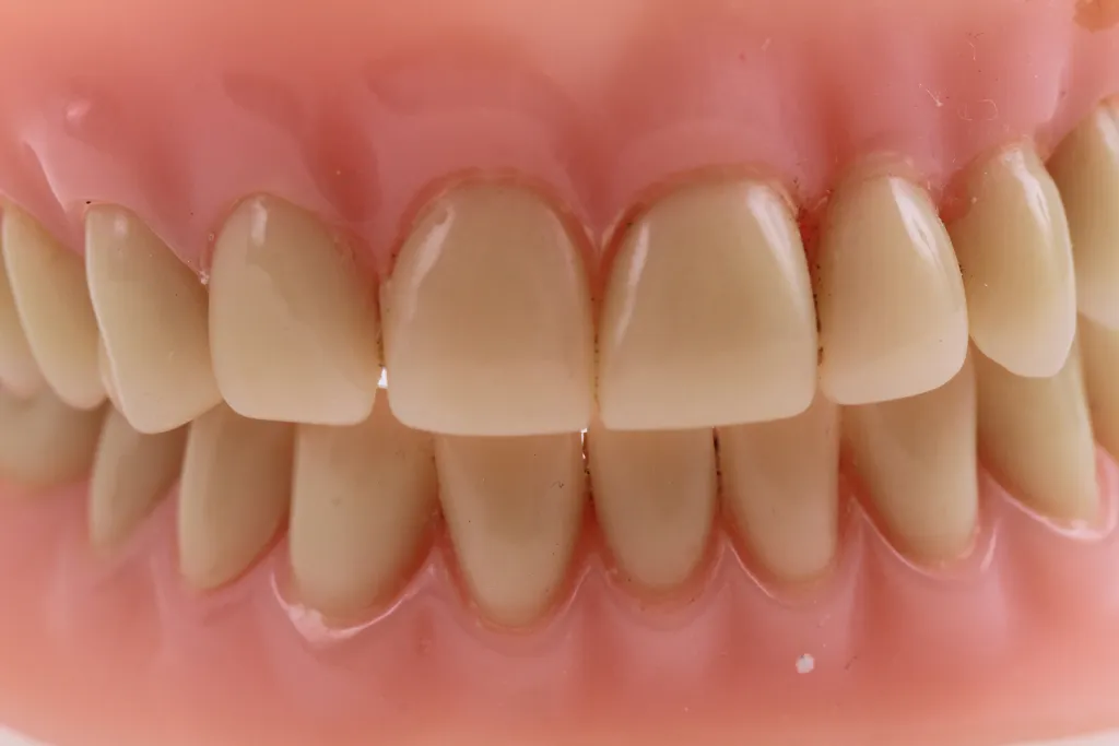 bigstock-Teeth-Prothesis-Background-164783822.webp