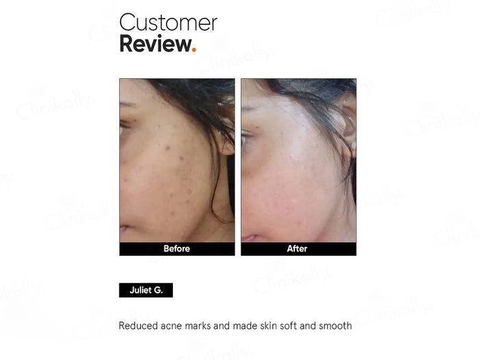 Thumbnail: Minimalist 5% Niacinamide Face Serum, 30ml