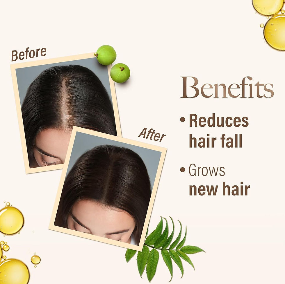 Thumbnail: Kesh King Ayurvedic Hair Oil|Hair Growth Oil, 200ml