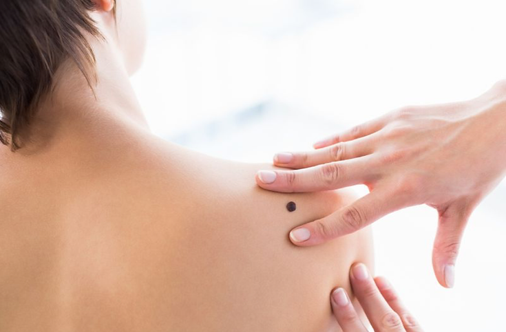 espalda con lunar.png