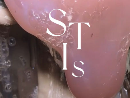 What are STIs? Have I had one?