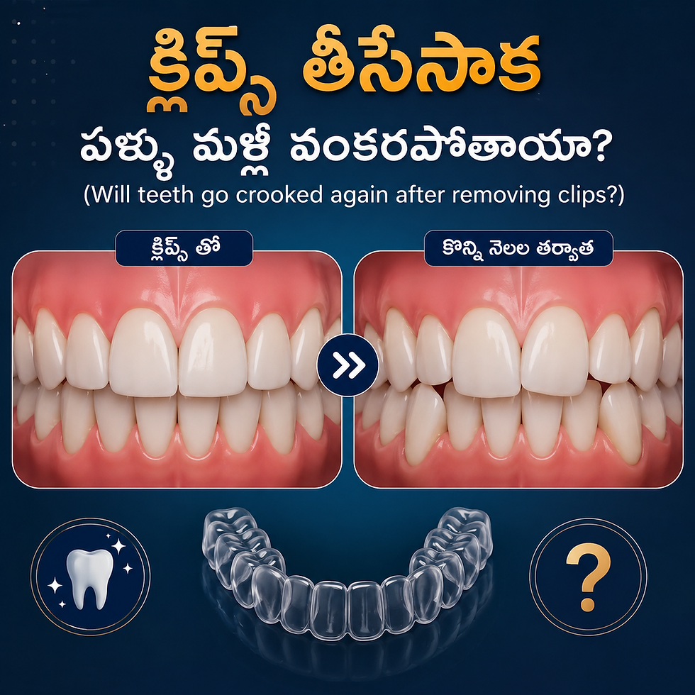 Do Teeth Move Back After Braces? Understanding Orthodontic Relapse and Why Retainers Matter