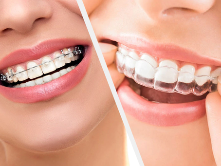 "Transform Your Smile with Kiran Dental Clinic's Advanced Dental Services"