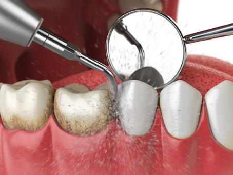"Maintaining Healthy Gums for a Lifetime: Kiran Dental Clinic's Proven Periodontal Care"