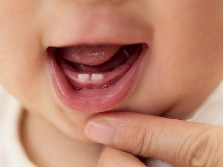 Preserving Your Child's Smile: The Importance of Caring for Baby Teeth at Kiran Dental Clinic