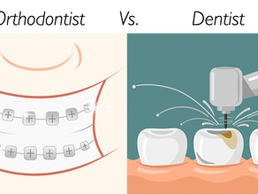 Dental Care Specialists: Dentist vs. Orthodontist - Understanding the Difference