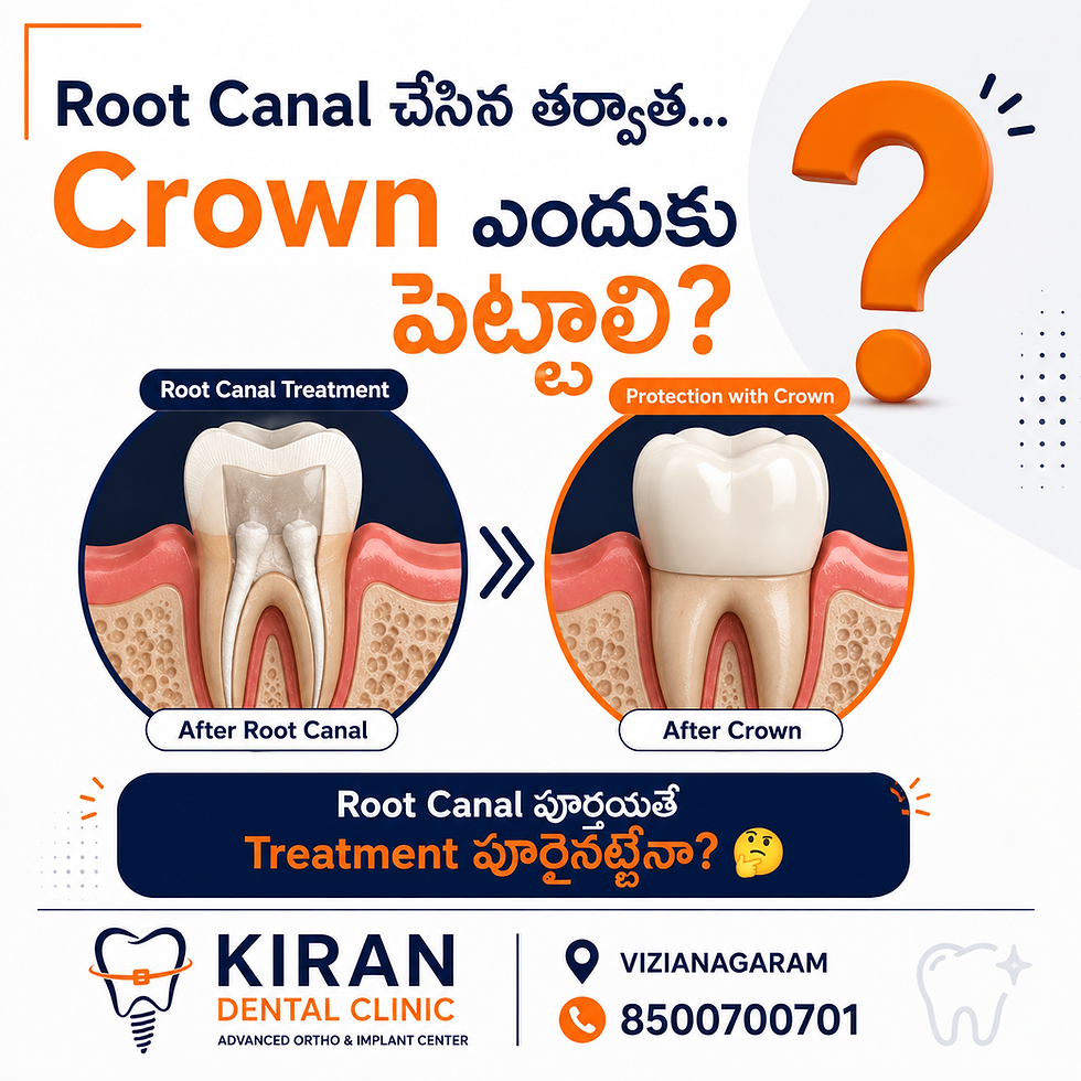 Why Does a Root Canal Treated Tooth Need a Crown?