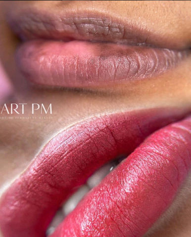 Before & After Dark Lip Neutralization by ART PM Chicago
