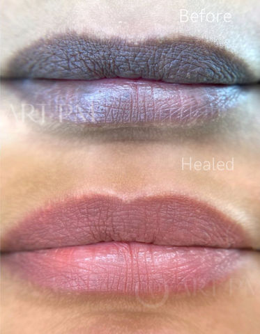 Before & After Dark Lip Neutralization by ART PM Chicago