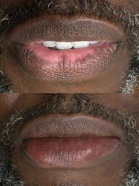 Lip Blushing Before & After by Art Pm Chicago