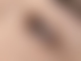 lash enhancement