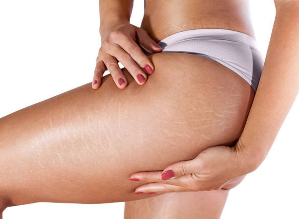 istockphoto-959614612-612x612.jpeg