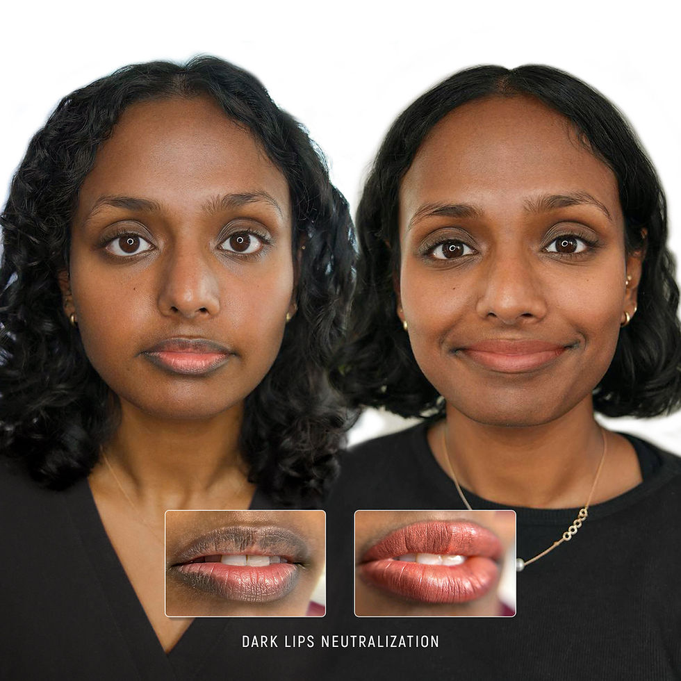 Client result after dark lip neutralization