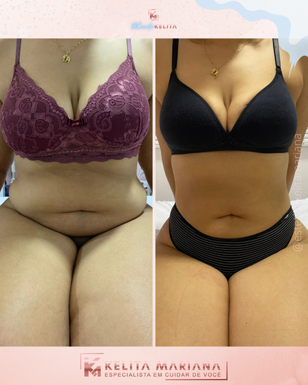 Crio Modelagem em Goiânia 