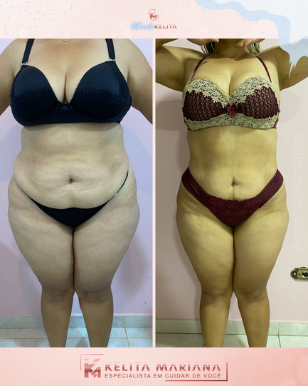 Crio Modelagem em Goiânia 