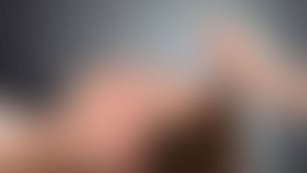 Como a acupuntura pode ajudar no processo de cicatrização de feridas?