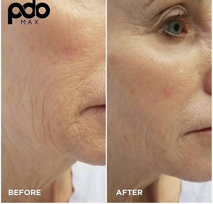 PDO-Threads-Before-After-PDO-Max.jpg