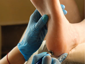 Chiropodist vs Podiatrist - What’s the Difference?