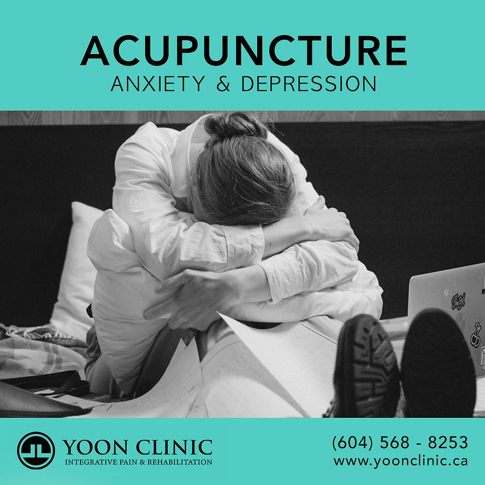Acupuncture for Anxiety and Depression Unlocking the Path to Emotional