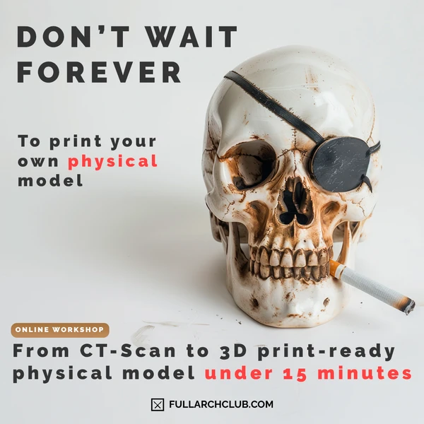 3D Print Your Dental Model