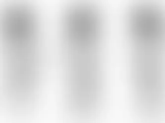 Luxating Patella in Dogs: What Puppy Owners Should Know