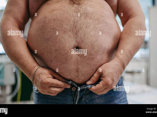❤️ OBESITY IS MORE THAN A NUMBER ON THE SCALE