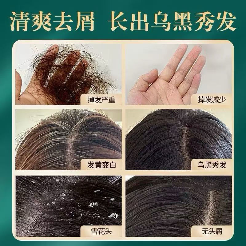 縮圖：烏斯曼草五黑烏髮皂4件