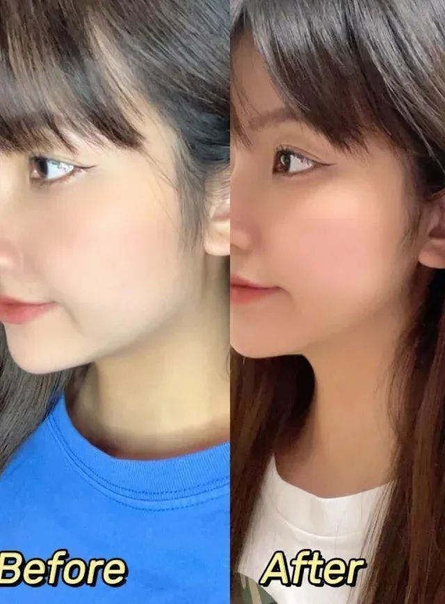 Thumbnail: 【反重力V臉紅繃帶面膜】