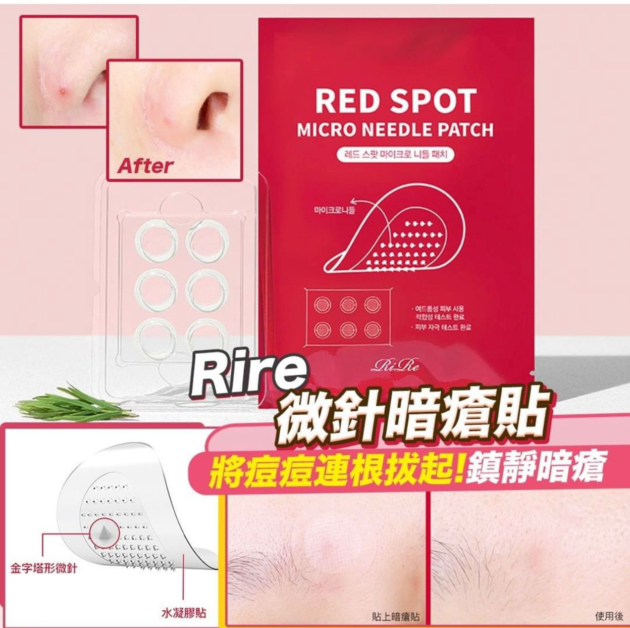 Korea 🇰🇷RIRE Micro Needle Acne Patch 6PCS NY2561478