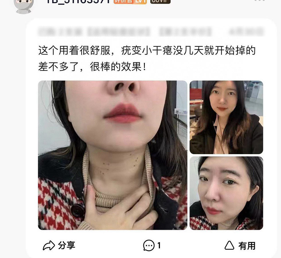 Thumbnail: 泰國🇹🇭SMEK扁平疣膏4瓶NYY6101272