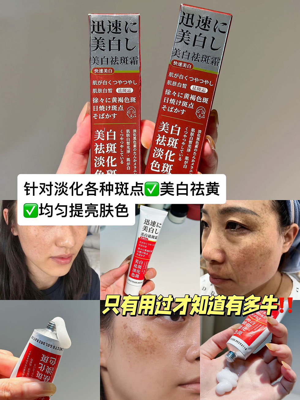 Thumbnail: 丸吉·美白祛斑霜2支