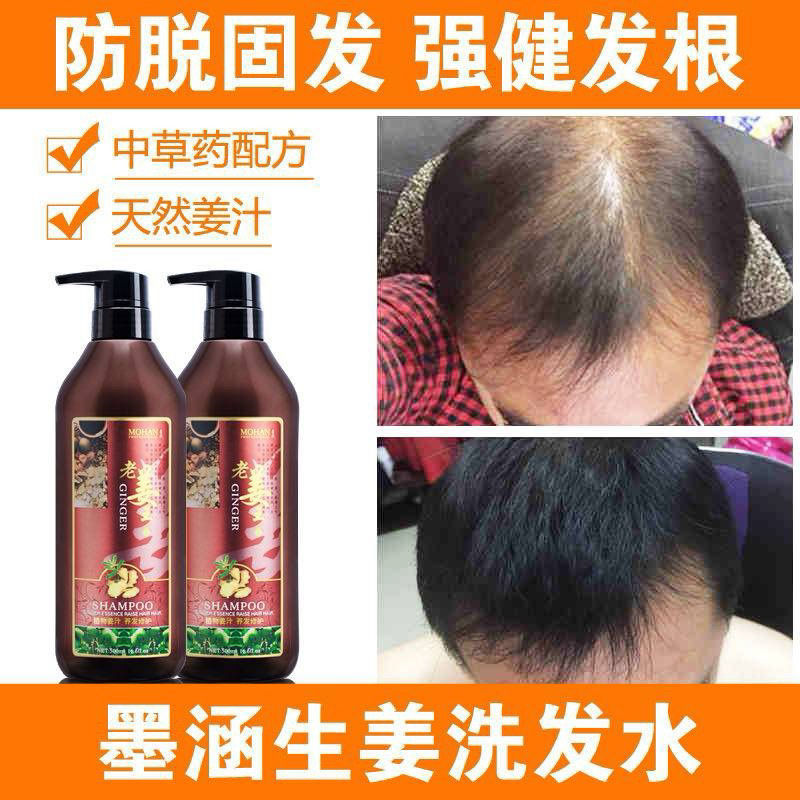 縮圖：墨涵老姜王真姜原液洗髮水2瓶