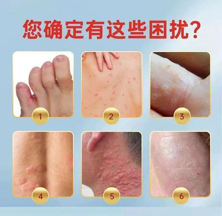 縮圖：香港大藥房真菌王3瓶
