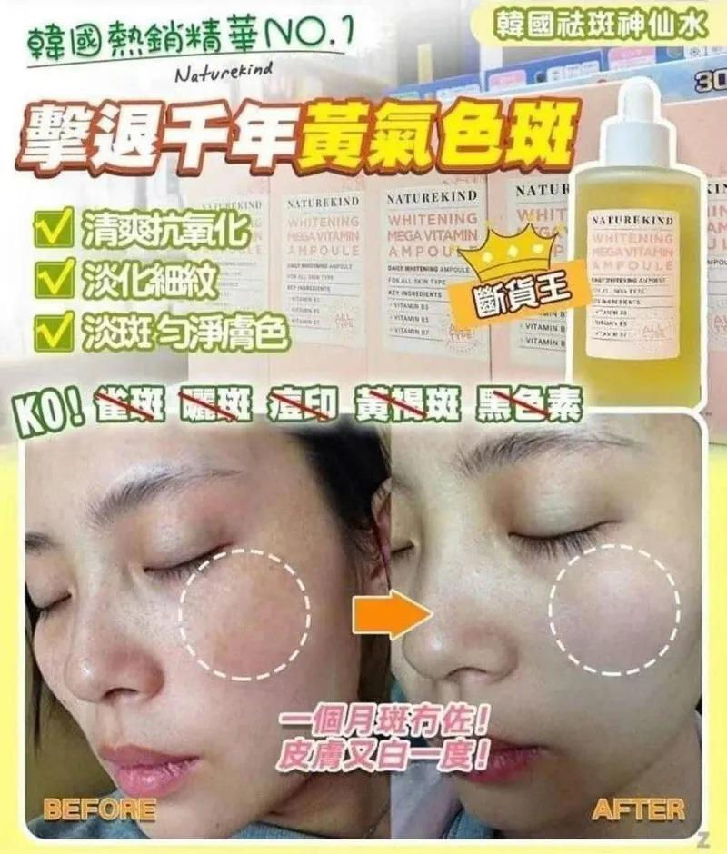 韓國祛斑神仙水NYY7213008