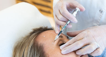 Injection toxine botulique