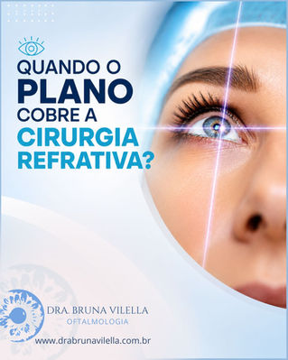 Quando o plano cobre a cirurgia refrativa? 