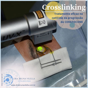 Tudo sobre o crosslinking: o que é, indicação e recuperação