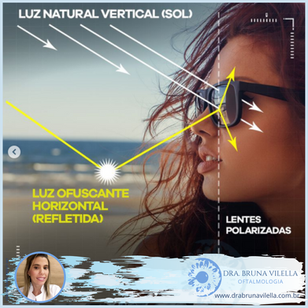 Quais as vantagens das lentes polarizadas?
