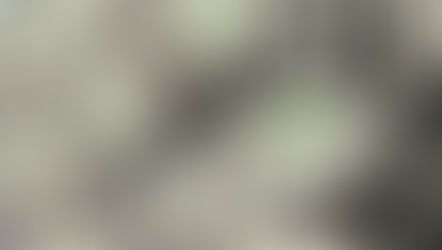 The Hidden Costs of Diabetes