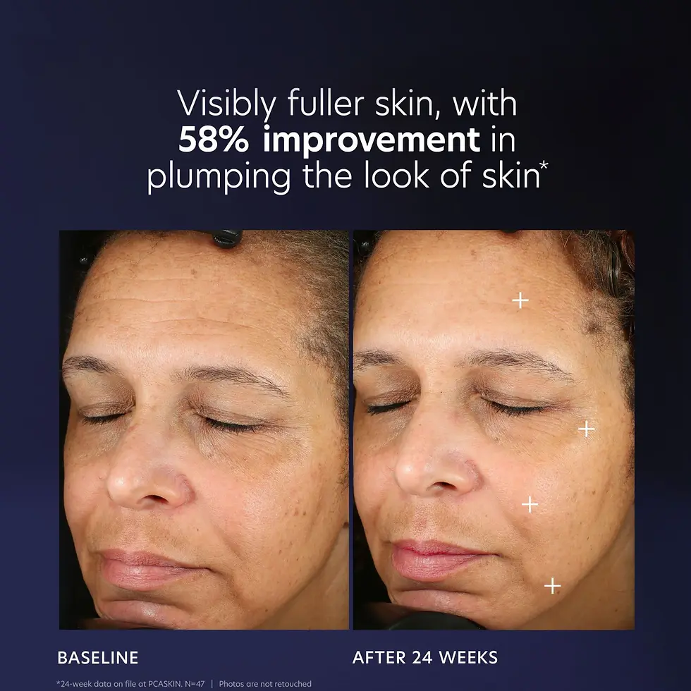 Thumbnail: PCA SKIN Pro-Max Age Renewal serum sold by Majesty Day Spa
